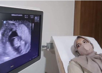 Mudah, Cara Menggunakan BPJS Untuk Periksa Kehamilan