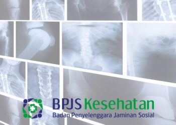 Apakah Rontgen Bisa Pakai BPJS? Simak Penjelasannya di Sini!