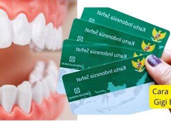 Cara Daftar Layanan Dokter Gigi BPJS Kesehatan Online
