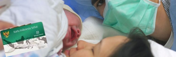 Ini Syarat agar Operasi Caesar Ditanggung BPJS, Catat Baik-Baik