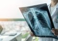 Syarat Menggunakan BPJS Kesehatan Untuk Rontgen