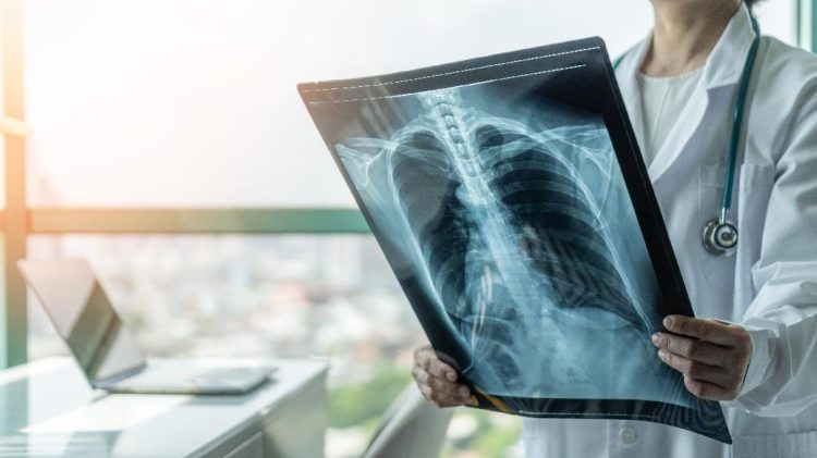 Syarat Menggunakan BPJS Kesehatan Untuk Rontgen