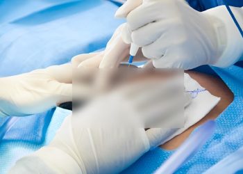 Update Syarat dan Ketentuan Operasi Caesar Menggunakan BPJS Tahun 2025