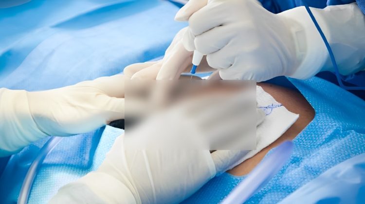 Update Syarat dan Ketentuan Operasi Caesar Menggunakan BPJS Tahun 2025