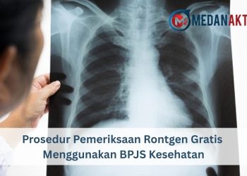 Prosedur Pemeriksaan Rontgen Gratis Menggunakan BPJS Kesehatan