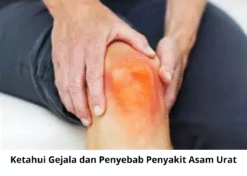 Ketahui Gejala dan Penyebab Penyakit Asam Urat