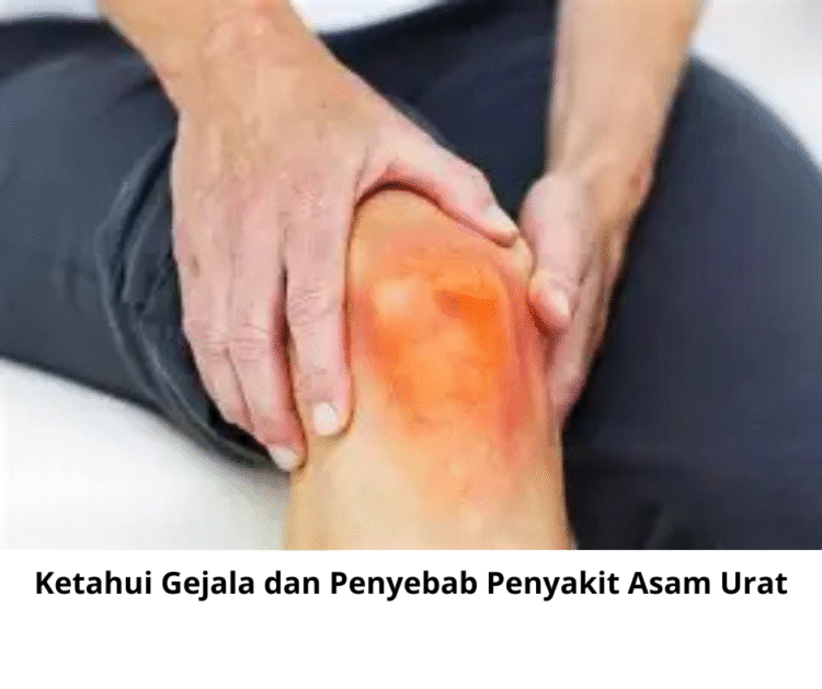 Ketahui Gejala dan Penyebab Penyakit Asam Urat
