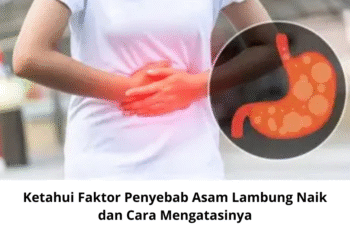 Ketahui Faktor Penyebab Asam Lambung Naik dan Cara Mengatasinya