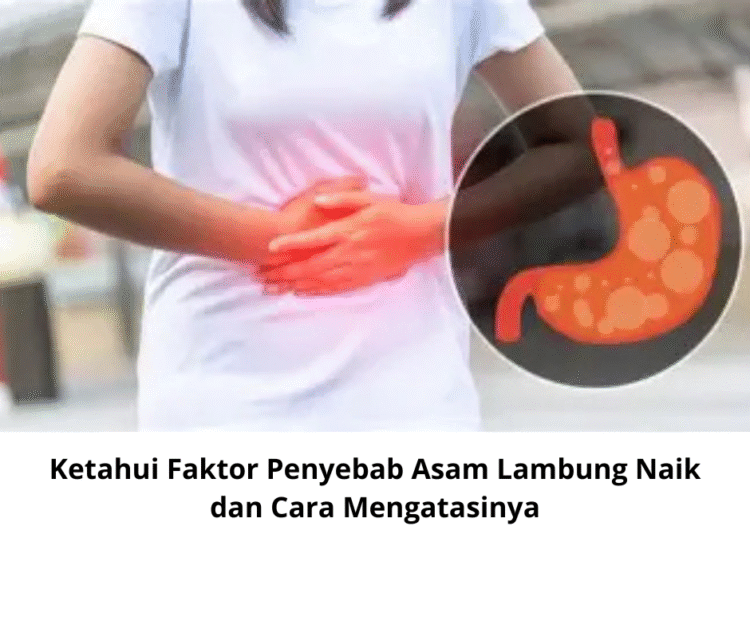 Ketahui Faktor Penyebab Asam Lambung Naik dan Cara Mengatasinya