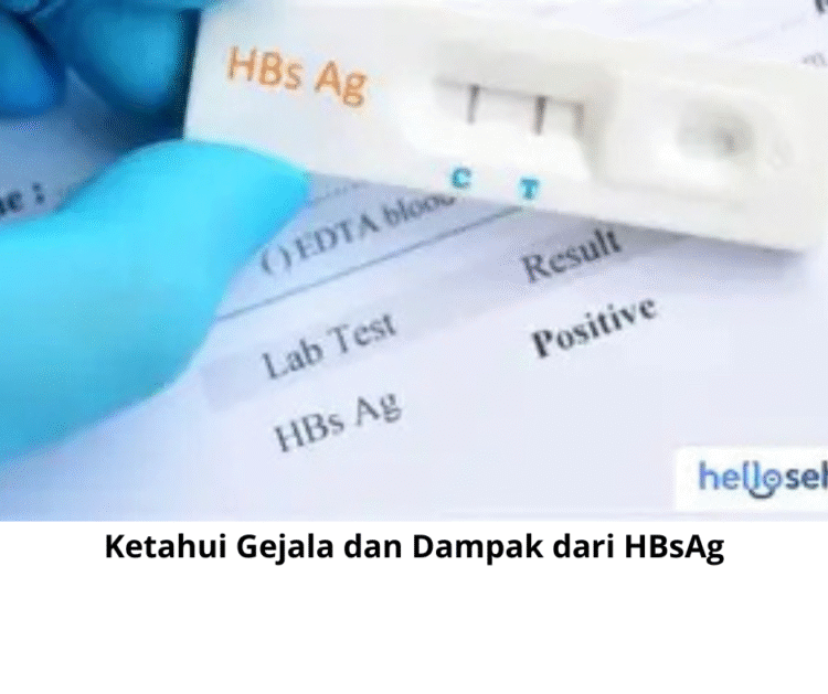 Ketahui Gejala dan Dampak dari HBsAg