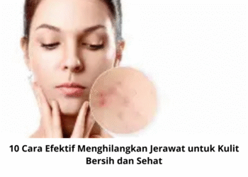 10 Cara Efektif Menghilangkan Jerawat untuk Kulit Bersih dan Sehat