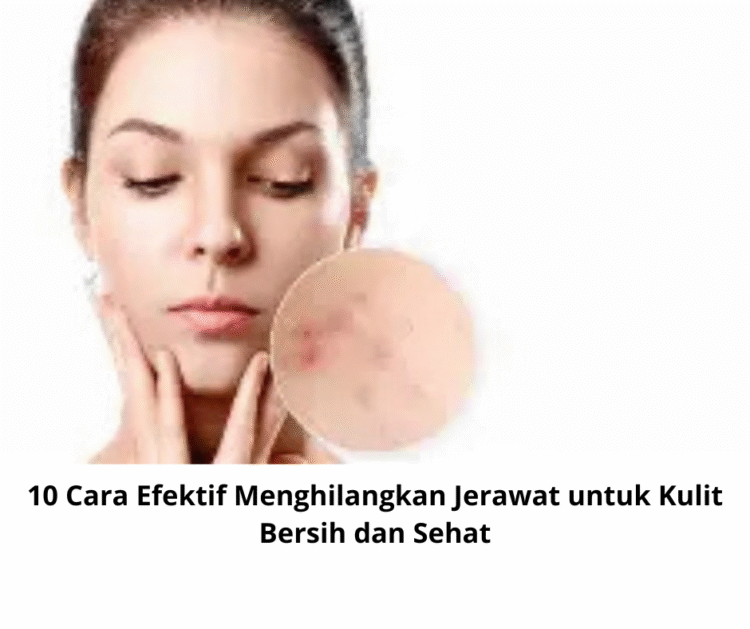 10 Cara Efektif Menghilangkan Jerawat untuk Kulit Bersih dan Sehat