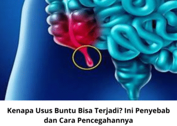 Kenapa Usus Buntu Bisa Terjadi? Ini Penyebab dan Cara Pencegahannya