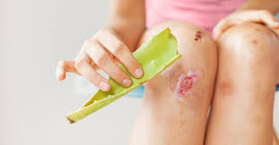 Luka Kecil Tak Boleh Sepele, Ini Cara Alami Menyembuhkannya